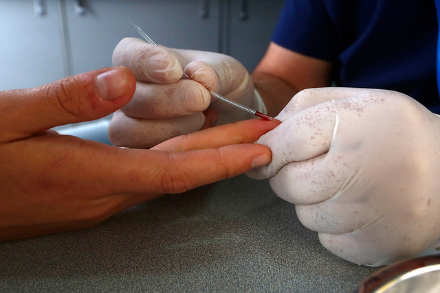 Hospital Clínico de U. de Chile lanza nueva campaña gratuita de exámenes de VIH